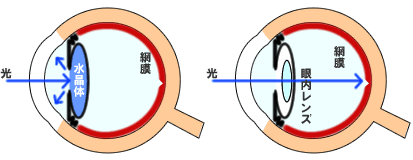 （素材提供：三島眼科医院）