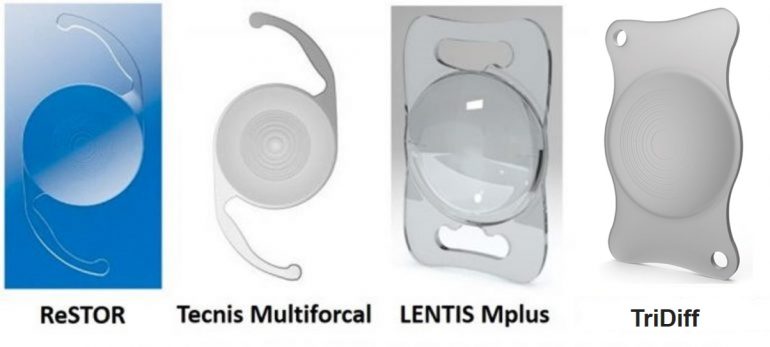 多焦点眼内レンズ一覧