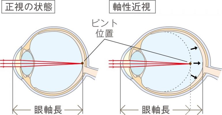 眼断面図